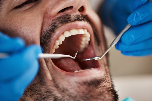 Best Walk-In Emergency Dentist in Roebling, NJ